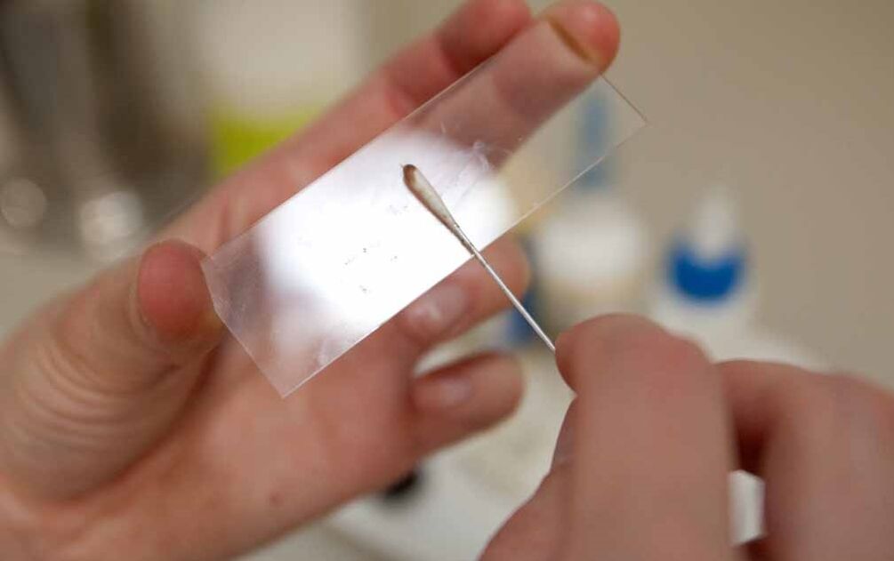 schrapen op de aanwezigheid van parasieten in het lichaam