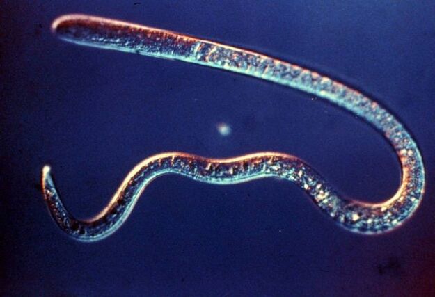 trichinella uit het menselijk lichaam
