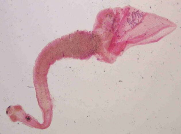 varkenslintworm van mensen