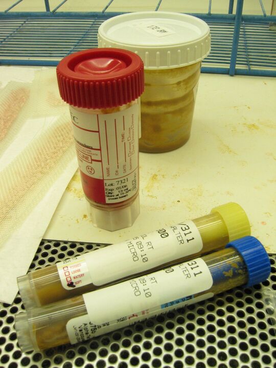 tests om parasieten op te sporen